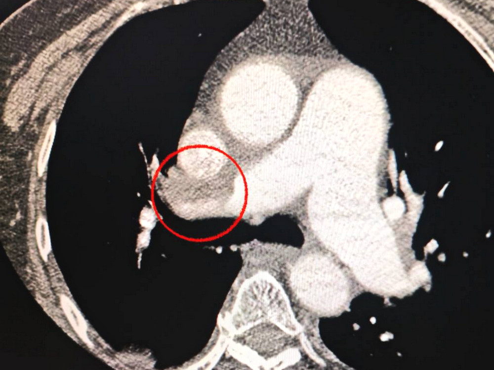 9278 image for slide